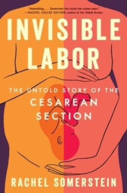 Invisible Labor : The Untold Story of the Cesarean Section - 9780063264427