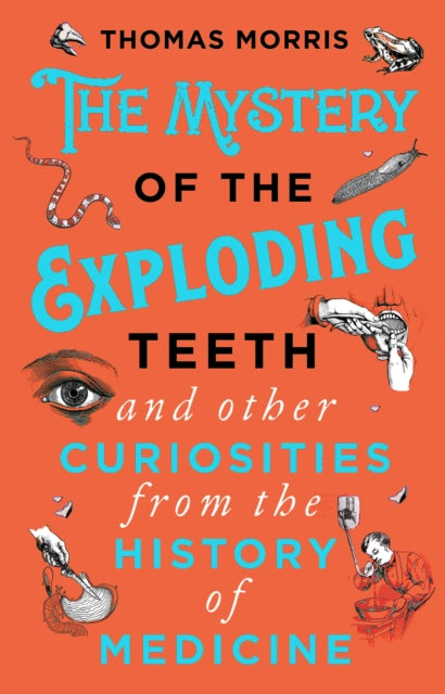 The Mystery of the Exploding Teeth and Other Curiosities from the History of Medicine - 9780552175456