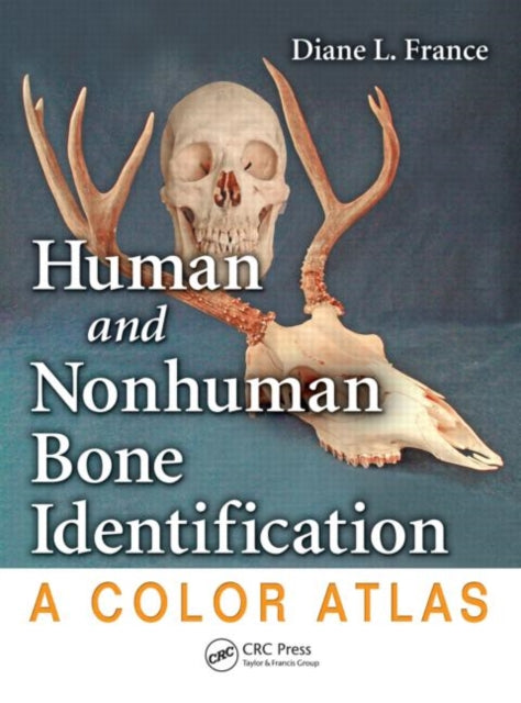 Human and Nonhuman Bone Identification : A Color Atlas - 9781420062861